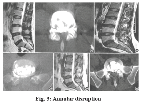 Annular