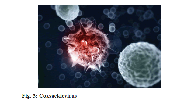 Coxsackievirus