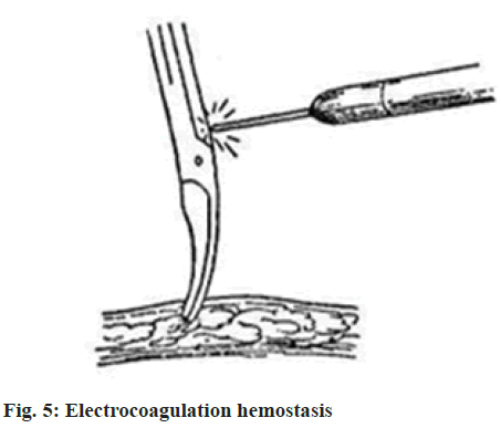 IJPS-Electrocoagulation