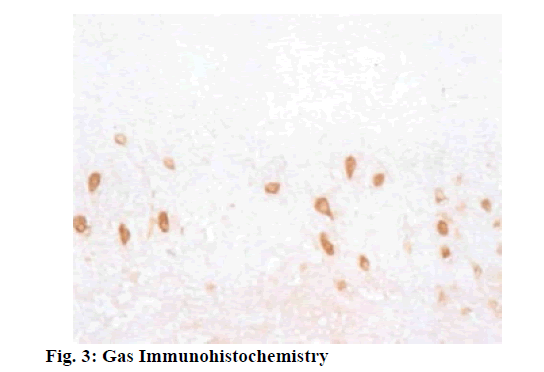 Relationship between Gastric Blood Perfusion and Gastric Mucosal Injury ...