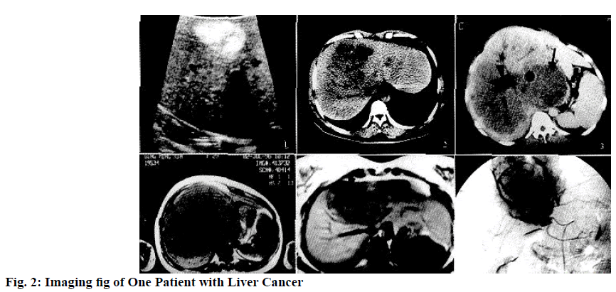 IJPS-Liver