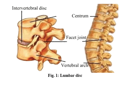 Lumbar