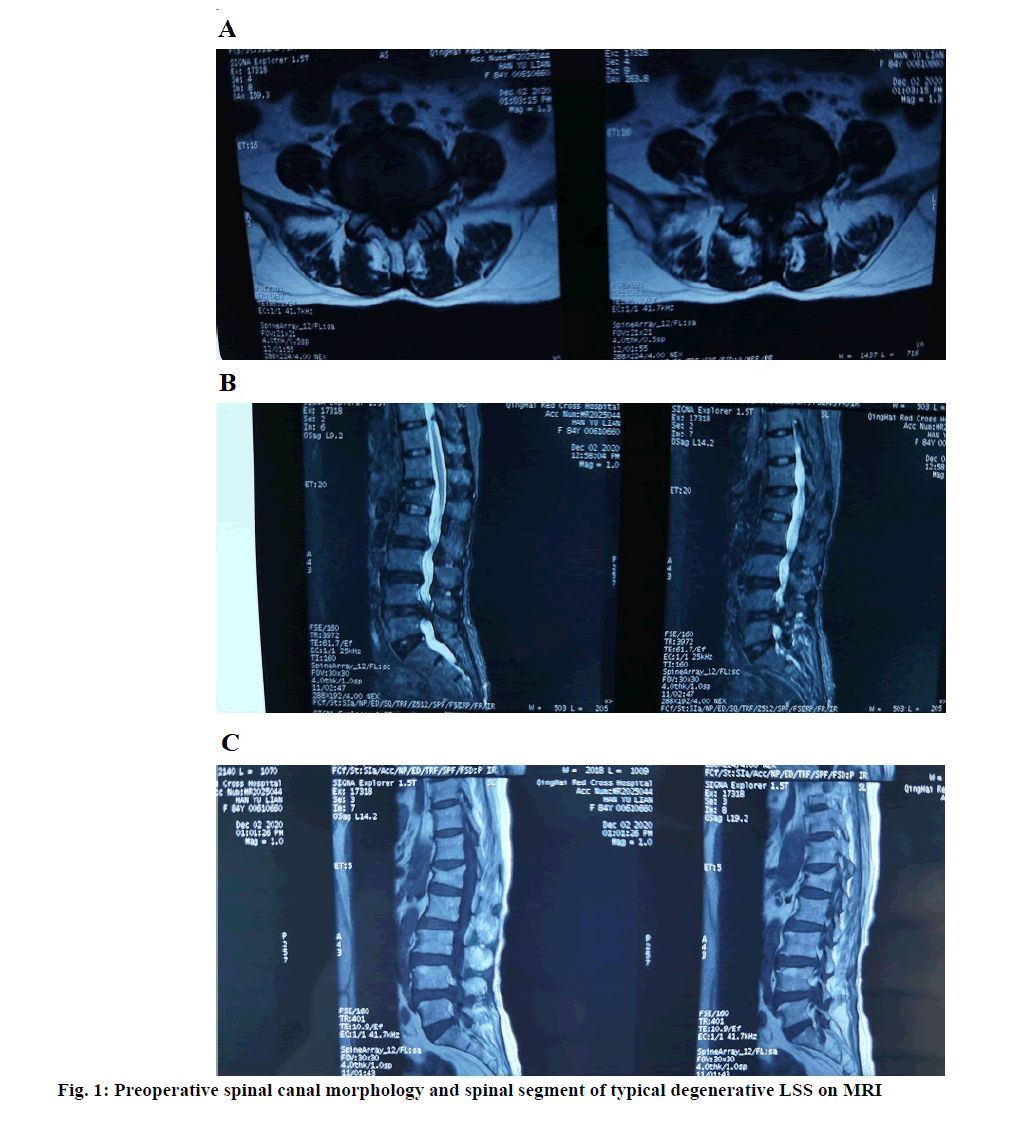 IJPS-MRI