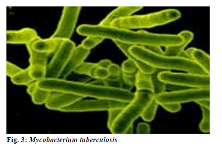 Mycobacterium