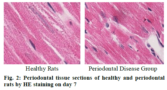 Periodontal