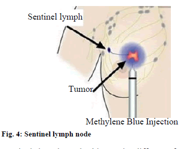 IJPS-Sentinel