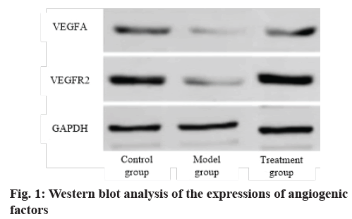 IJPS-angiogenic