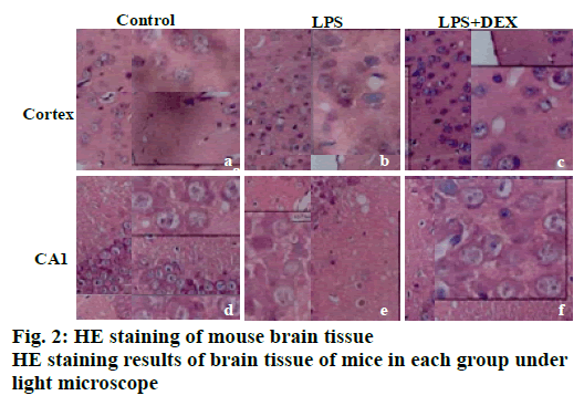 IJPS-brain