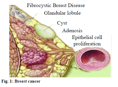 IJPS-cancer