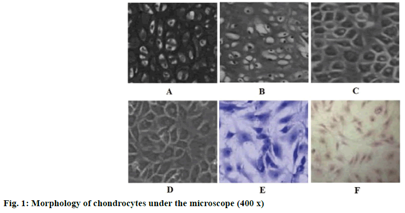 chondrocytes