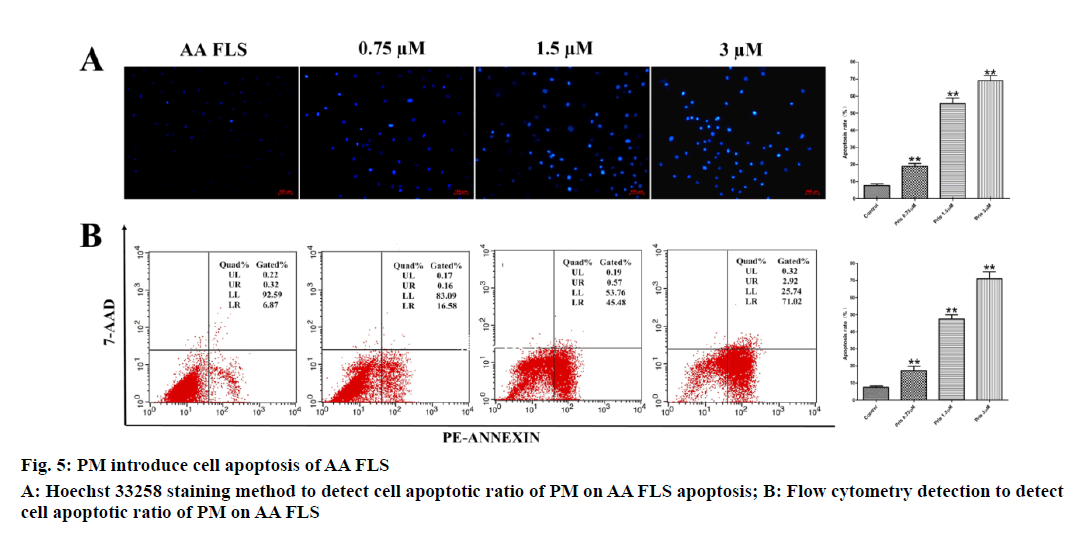 IJPS-detect