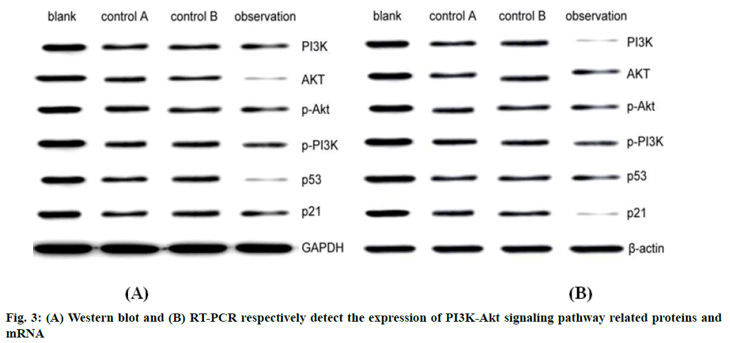 IJPS-detect