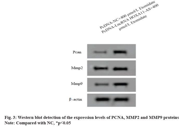 IJPS-detection