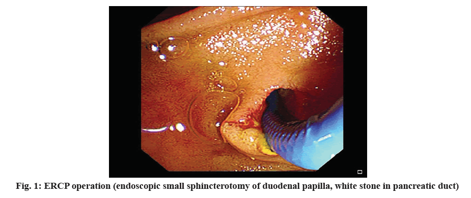 IJPS-duodenal