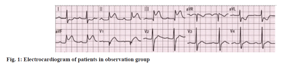 IJPS-electrocardiogram