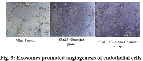 IJPS-endothelial