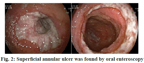 IJPS-enteroscopy