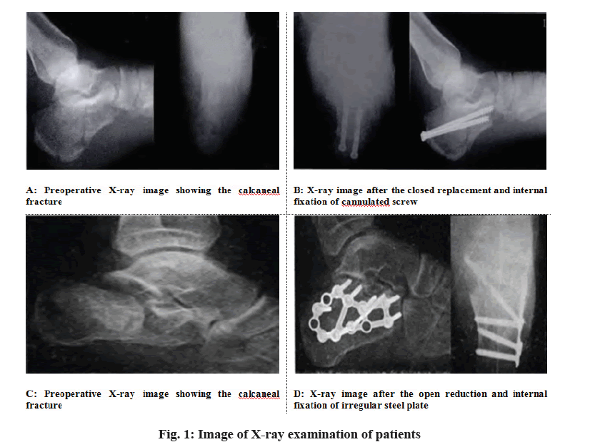 IJPS-examination