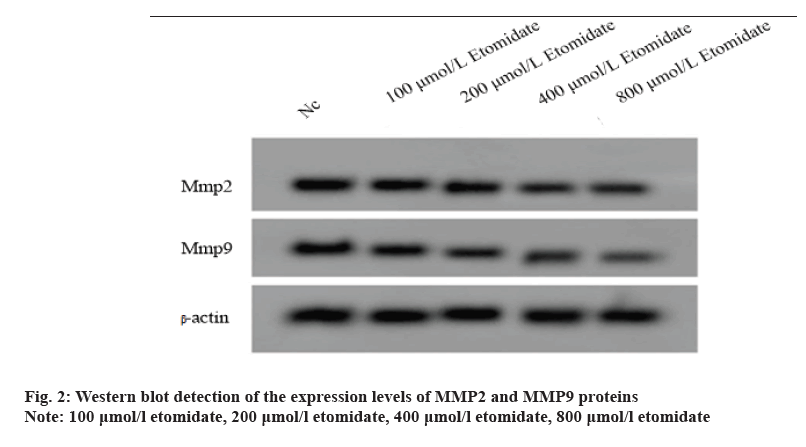 IJPS-expression