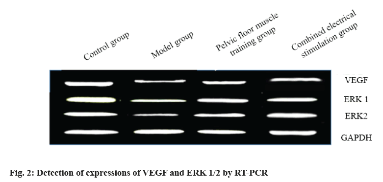 IJPS-expressions