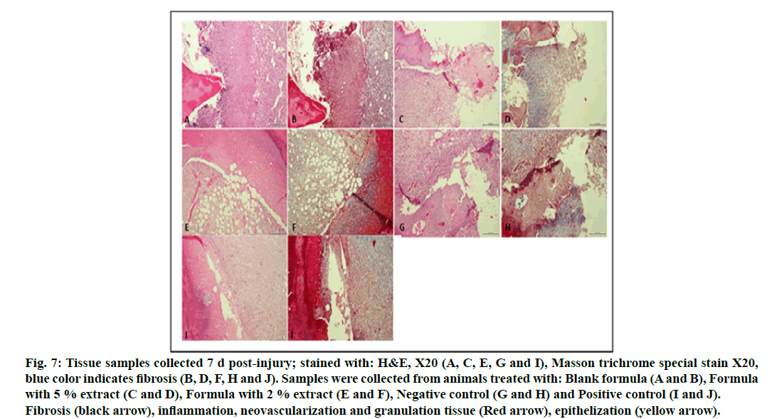 IJPS-fibrosis