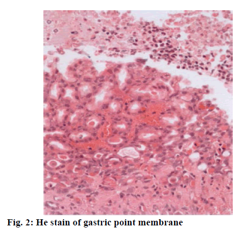 IJPS-gastric