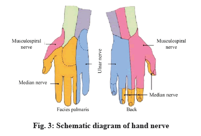 IJPS-hand-nerve