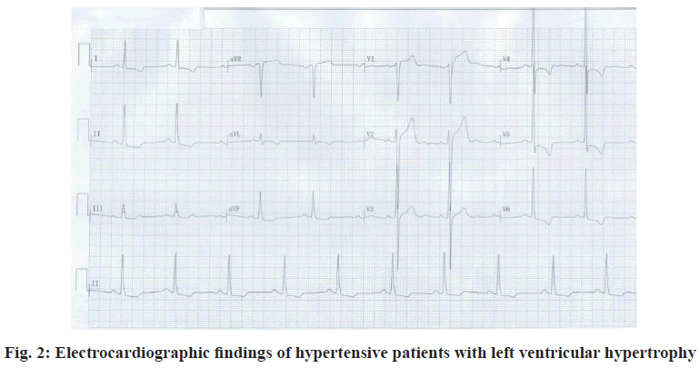 IJPS-hypertrophy