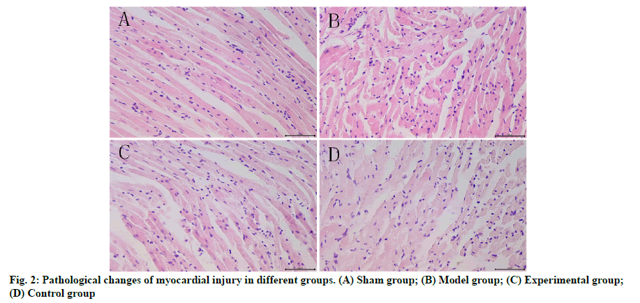 IJPS-injury