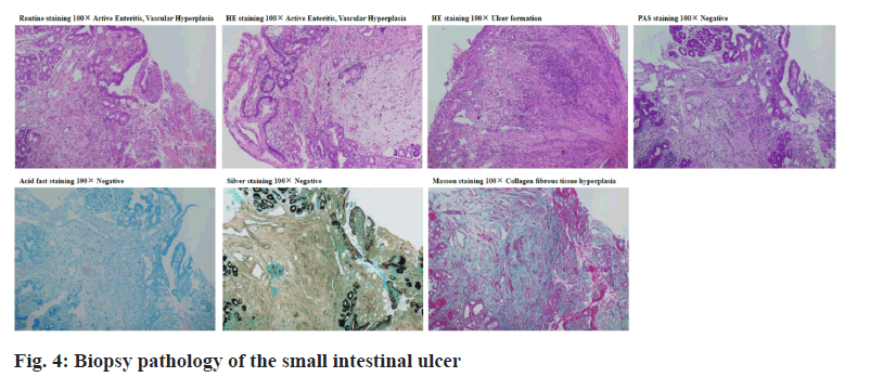 IJPS-intestinal