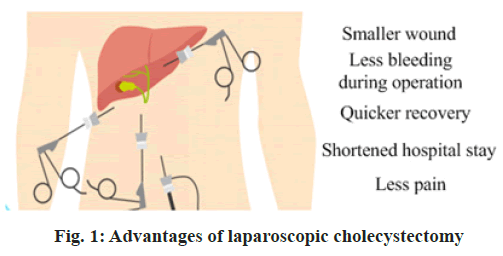 IJPS-laparoscopic