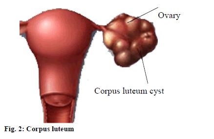 luteum