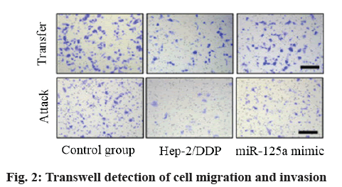 IJPS-migration