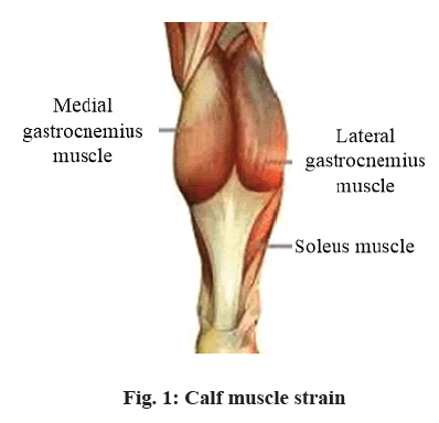 IJPS-muscle