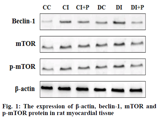 IJPS-myocardial