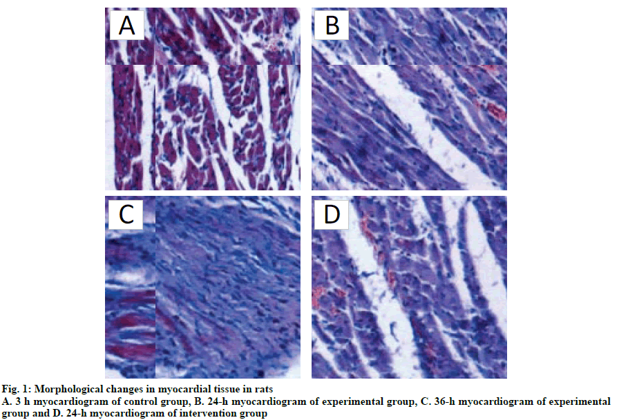 IJPS-myocardial