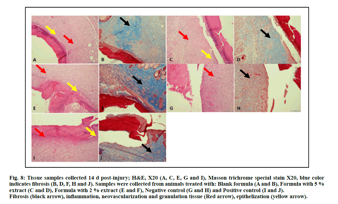 IJPS-neovascularization