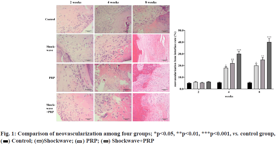 neovascularization