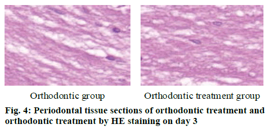 orthodontic