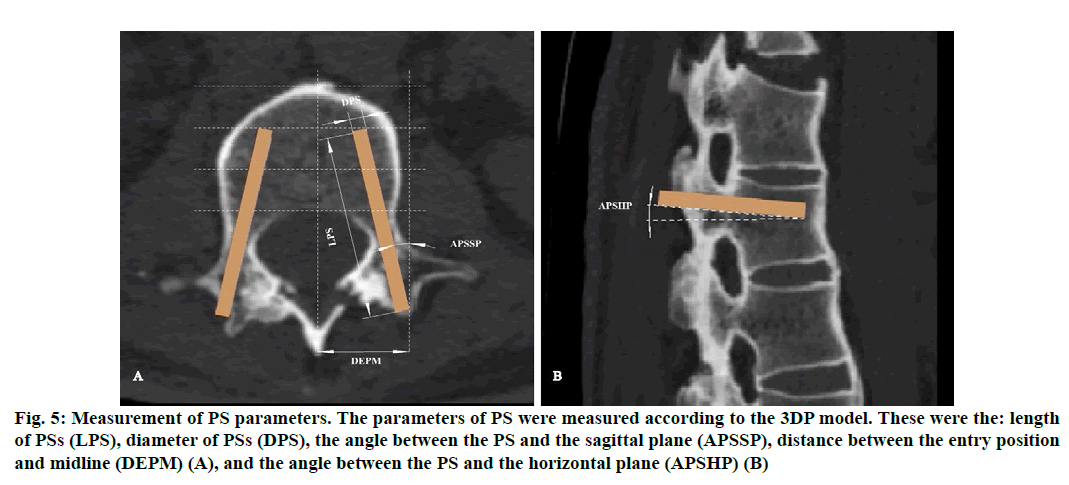 IJPS-parameters