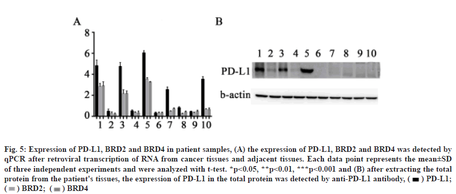 IJPS-patient