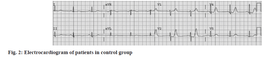 IJPS-patients