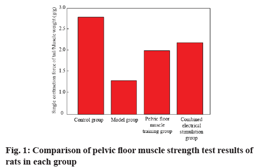 IJPS-pelvic