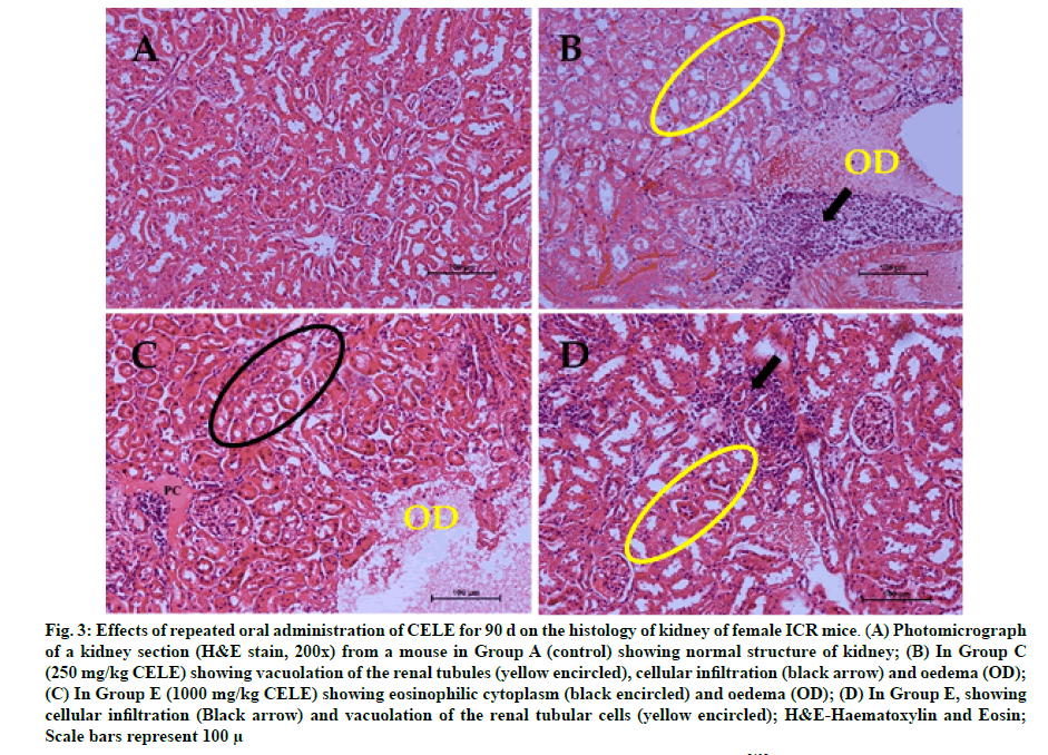 IJPS-renal