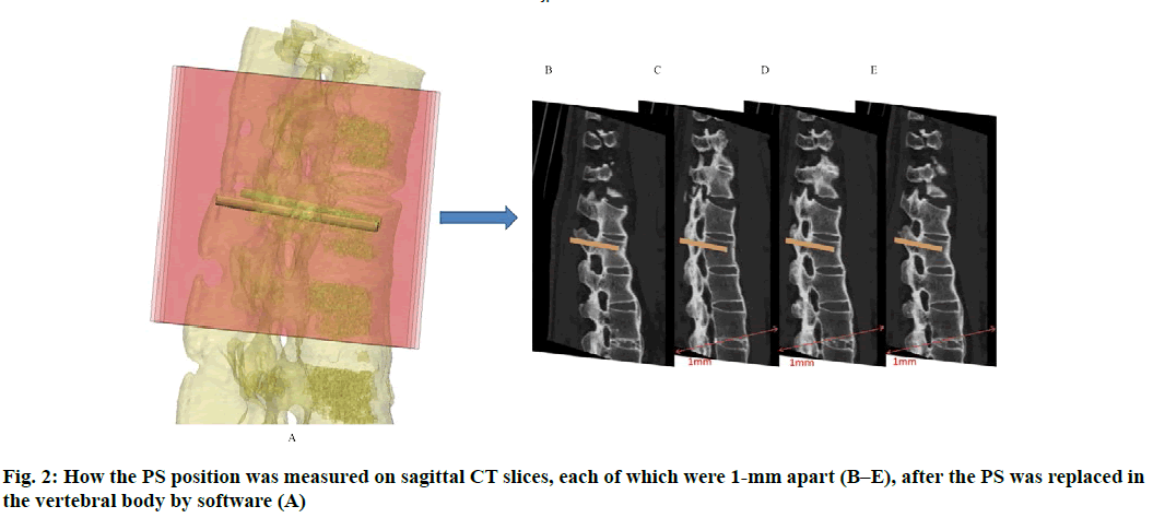 IJPS-sagittal