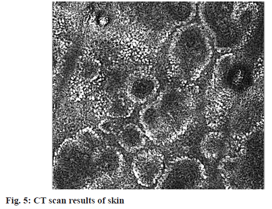 IJPS-scan