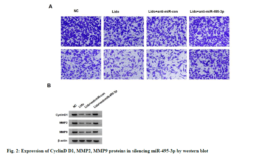 IJPS-silencing