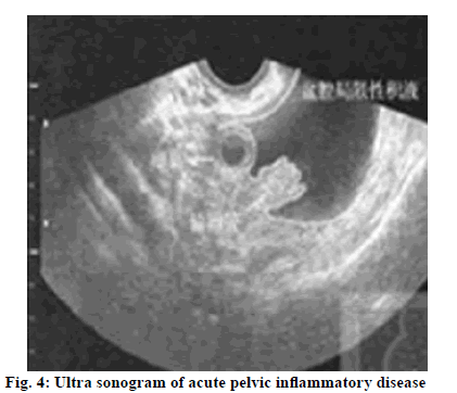 sonogram