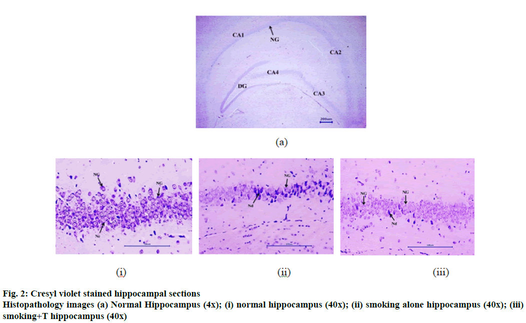 IJPS-stained