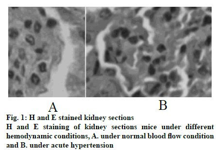 IJPS-stained-kidney